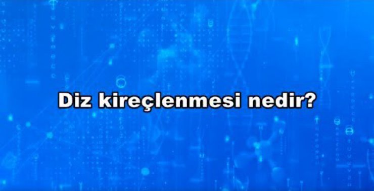 Diz Protezi (kireçlenme) Ameliyatı Tüm Detaylar - Avrupa Ortopedi Cerrahisi